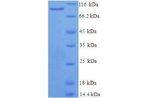 SDS-PAGE (SDS) image for X-Prolyl Aminopeptidase (Aminopeptidase P) 1, Soluble (XPNPEP1) (AA 2-623) protein (His-SUMO Tag) (ABIN5711863)