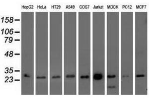 Image no. 3 for anti-OTU Domain, Ubiquitin Aldehyde Binding 2 (OTUB2) antibody (ABIN1499938) (OTUB2 antibody)