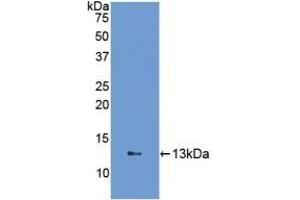Detection of Recombinant FABP1, Human using Polyclonal Antibody to Fatty Acid Binding Protein 1 (FABP1) (FABP1 antibody  (AA 2-127))