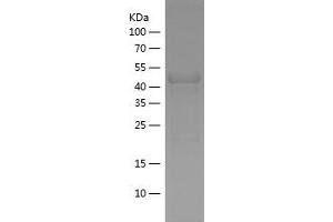 PIAS4 Protein (AA 334-510) (His-IF2DI Tag)