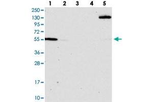 Western blot analysis of Lane 1: RT-4, Lane 2: U-251 MG, Lane 3: Human Plasma, Lane 4: Liver, Lane 5: Tonsil with OSBPL2 polyclonal antibody  at 1:100-1:250 dilution.