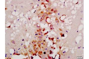 Formalin-fixed and paraffin embedded rat brain labeled with Anti-TG9B Polyclonal Antibody, Unconjugated  at 1:200 followed by conjugation to the secondary antibody and DAB staining (ATG9B antibody  (AA 351-450))