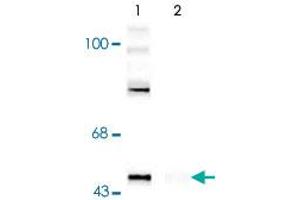 Western blot of rat cortex lysate showing specific immunolabeling of the ~50k Gap43 protein phosphorylated at Ser41 (Control).