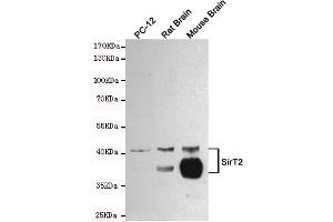 Western blot detection of SirT2 in PC-12, Rat Brain and Mouse Brain cell lysates using SirT2 mouse mAb (1:1000 diluted). (SIRT2 antibody)