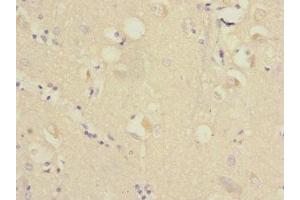 Immunohistochemistry of paraffin-embedded human brain tissue using ABIN7167403 at dilution of 1:100 (RAP2B antibody  (AA 1-183))