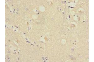 Immunohistochemistry of paraffin-embedded human brain tissue using ABIN7167403 at dilution of 1:100 (RAP2B antibody  (AA 1-183))