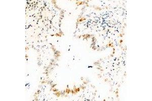 Immunohistochemical analysis of USP36 staining in human kidney formalin fixed paraffin embedded tissue section. (USP36 antibody)