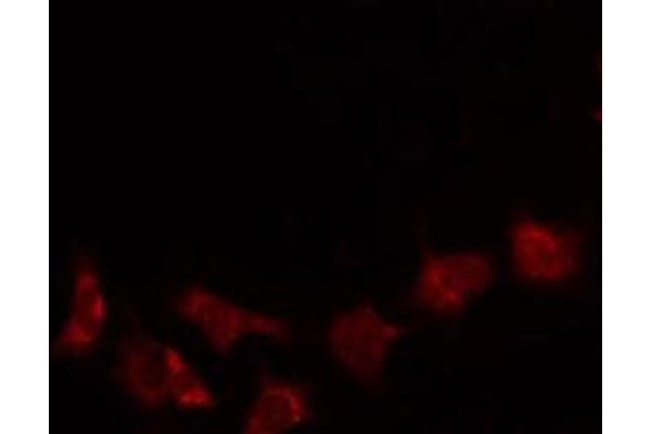 Stathmin 3 antibody  (Internal Region)