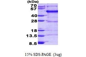 SDS-PAGE (SDS) image for Filamin Binding LIM Protein 1 (FBLIM1) (AA 1-373) protein (His tag) (ABIN6387197) (FBLIM1 Protein (AA 1-373) (His tag))