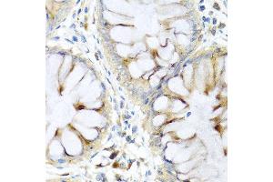 Immunohistochemistry of paraffin-embedded human colon using PI3 antibody at dilution of 1:100 (40x lens).