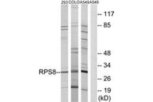 Western blot analysis of extracts from A549/293/COLO cells, using RPS8 Antibody. (RPS8 antibody  (AA 111-160))