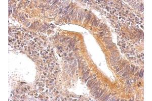 Immunohistochemistry (IHC) image for anti-Enolase 3 (Beta, Muscle) (ENO3) antibody (ABIN2856900)