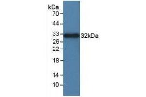 Detection of Recombinant ITGaD, Rat using Polyclonal Antibody to Integrin Alpha D (ITGaD) (ITGAD antibody  (AA 879-1099))