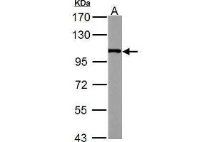 WB Image alpha Actinin 4 antibody [C2C3], C-term detects ACTN4 protein by Western blot analysis. (alpha Actinin 4 antibody  (C-Term))
