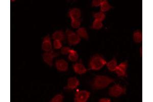 ABIN6268912 staining HepG2 by IF/ICC. (DDR1 antibody  (C-Term))