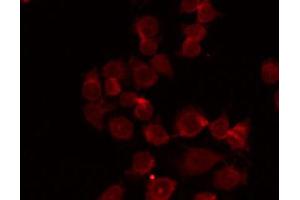 ABIN6268912 staining HepG2 by IF/ICC. (DDR1 antibody  (C-Term))