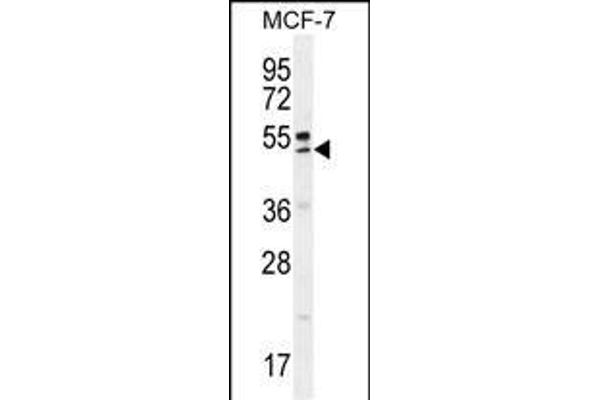 QTRTD1 antibody  (C-Term)