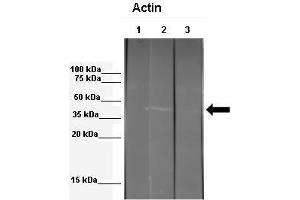 WB Suggested Anti-ACTB Antibody  Positive Control: Lane 1: 341 µg mouse 3T3 ECM extract + blocking peptide, Lane 2: 041 µg mouse 3T3 ECM extract, Lane 3: 041 µg Echinococcus granulosus extract Primary Antibody Dilution: 1:000Secondary Antibody: Anti-rabbit-HRP Secondry  Antibody Dilution: 1:00,000Submitted by: Anonymous (beta Actin antibody  (Middle Region))