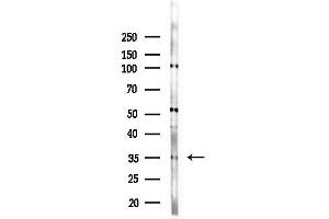 anti-Dehydrogenase/reductase (SDR Family) Member 9 (DHRS9) (Internal Region) antibody