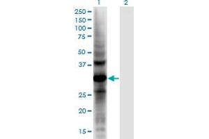 Western Blot analysis of AKR1CL2 expression in transfected 293T cell line by AKR1CL2 monoclonal antibody (M02), clone 1C8. (AKR1E2 antibody  (AA 1-307))