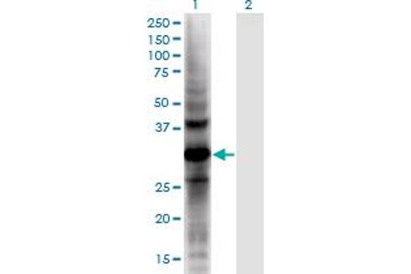AKR1E2 anticorps  (AA 1-307)