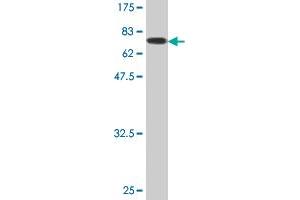 Western Blot detection against Immunogen (78. (FH antibody  (AA 33-510))