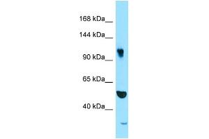 WB Suggested Anti-SYNRG Antibody Titration: 1. (SYNRG antibody  (N-Term))