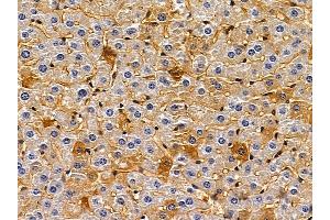 ABIN6258192 and ABIN6273897 at 1/100 staining mouse liver tissue by IHC-P.