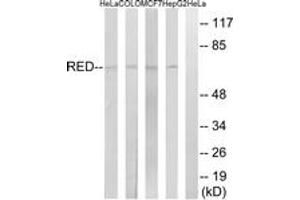 Western blot analysis of extracts from HepG2/MCF-7/COLO/HeLa cells, using RED Antibody.