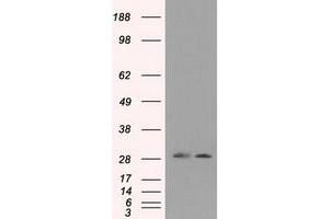 HEK293T cells were transfected with the pCMV6-ENTRY control (Left lane) or pCMV6-ENTRY RPA2 (Right lane) cDNA for 48 hrs and lysed. (RPA2 antibody)