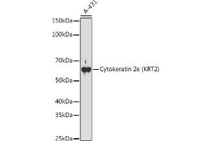 Western blot analysis of extracts of A-431 cells, using Cytokeratin 2e (KRT2) antibody (ABIN1680763, ABIN3016322, ABIN3016323 and ABIN7101480) at 1:1000 dilution. (Keratin 2 antibody)