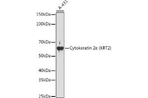 Keratin 2 antibody