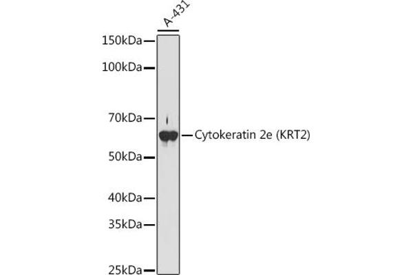 Keratin 2 antibody