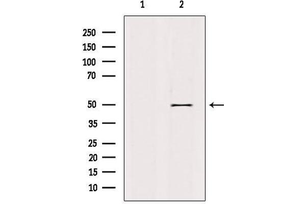 Retinoid X Receptor gamma antibody  (Internal Region)