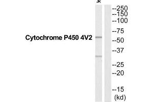 Western Blotting (WB) image for anti-Cytochrome P450, Family 4, Subfamily V, Polypeptide 2 (CYP4V2) (Internal Region) antibody (ABIN1852634)