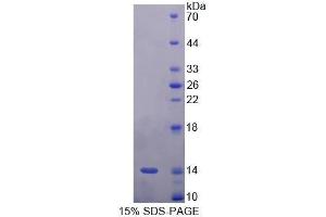 SDS-PAGE (SDS) image for Corin, Serine Peptidase (CORIN) (AA 533-634) protein (His tag) (ABIN1079279)