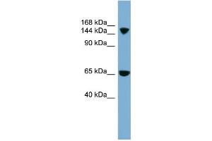 WB Suggested Anti-SLC4A5 Antibody Titration:  0.