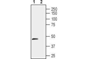 Western blot analysis of rat dorsal root ganglia lysates: - 1. (STOML1 antibody  (Extracellular, N-Term))