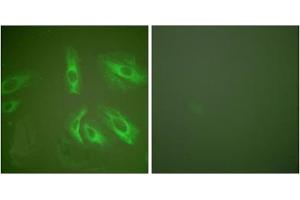 Immunofluorescence analysis of HeLa cells, using Gastrin antibody (ABIN5976408). (Gastrin antibody  (Internal Region))