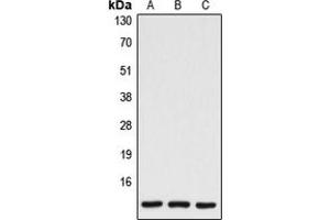 Western blot analysis of Caspase 7 p11 expression in HEK293T (A), mouse spleen (B), rat spleen (C) whole cell lysates. (Caspase 7 p11 (Center) antibody)