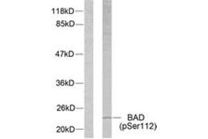Western blot analysis of extracts from 293 cells treated with Forskolin, using BAD (Phospho-Ser112) Antibody. (BAD antibody  (pSer75))