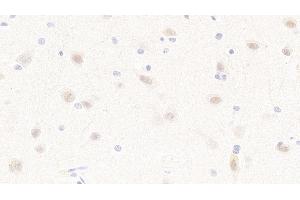 Detection of MAP2K4 in Human Cerebrum Tissue using Polyclonal Antibody to Mitogen Activated Protein Kinase Kinase 4 (MAP2K4) (MAP2K4 antibody  (AA 137-394))