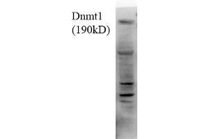 Dnmt1, 18ug H1299 lysate 1 in1000 Western Blotting. (DNMT1 antibody  (AA 620-950))
