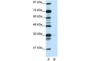 WB Suggested Anti-NANOG Antibody   Titration: 1. (Nanog antibody  (N-Term))