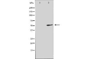 Western blot analysis of extracts from COLO205 cells, using NK3R antibody. (TACR3 antibody  (C-Term))