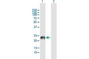 Western Blot analysis of GAGE7 expression in transfected 293T cell line by GAGE7 MaxPab polyclonal antibody. (G Antigen 7 antibody  (AA 1-117))