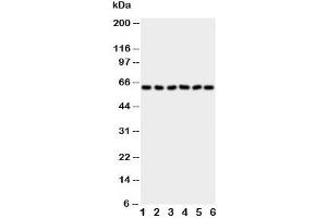 Western blot testing of PAK1 antibody and Lane 1:  rat testis (PAK1 antibody  (AA 1-14))