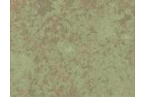 Hsp60 (LK 2), Listeria infected mice spleens 6 days after infection with L monocytogenes. (HSPD1 antibody)