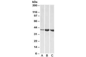 Western blot testing of A) human, B) mouse and C) rat skeletal muscle lysates with Aldolase A antibody at 1ug/ml. (ALDOA antibody)