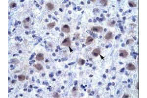 Image no. 1 for anti-Ring Finger Protein 141 (RNF141) (AA 96-145) antibody (ABIN6735889) (RNF141 antibody  (AA 96-145))
